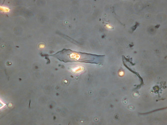 Dinobryon crenulatum