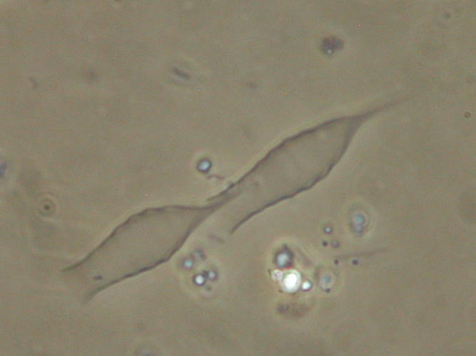 Dinobryon crenulatum