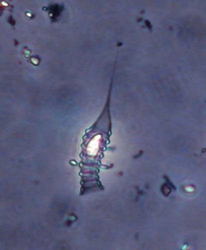 Dinobryon suecicum